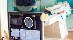 앨버타, 의사 처방 없이 MRI 등 검사 본인 부담으로 가능해져