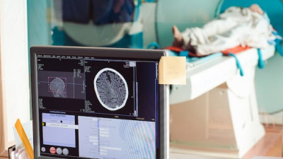 앨버타, 의사 소견 없이 MRI 등 검사 비용 지불 허용